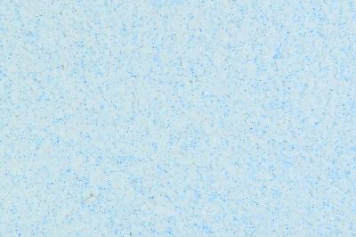 Liquid wallpaper Ekobarvi 4.01 Glitter